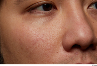 HD Face Skin Allvince Epps cheek eye face nose skin…